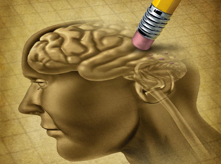 mózg alzheimer